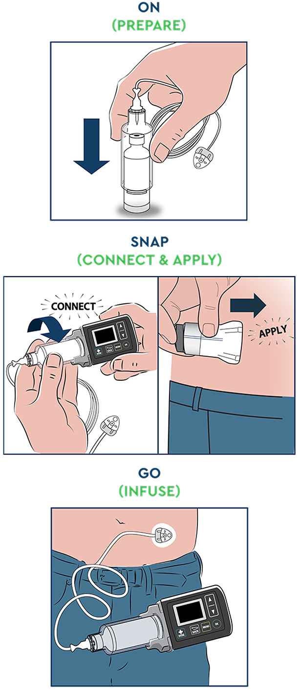A diagram showing how to set up ONAPGO: on (prepare), snap (connect and apply), go (infuse)